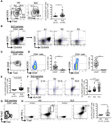 Enhanced Fatty Acid Synthesis Leads to Subset Imbalance and IFN-γ Overproduction in T Helper 1 Cells